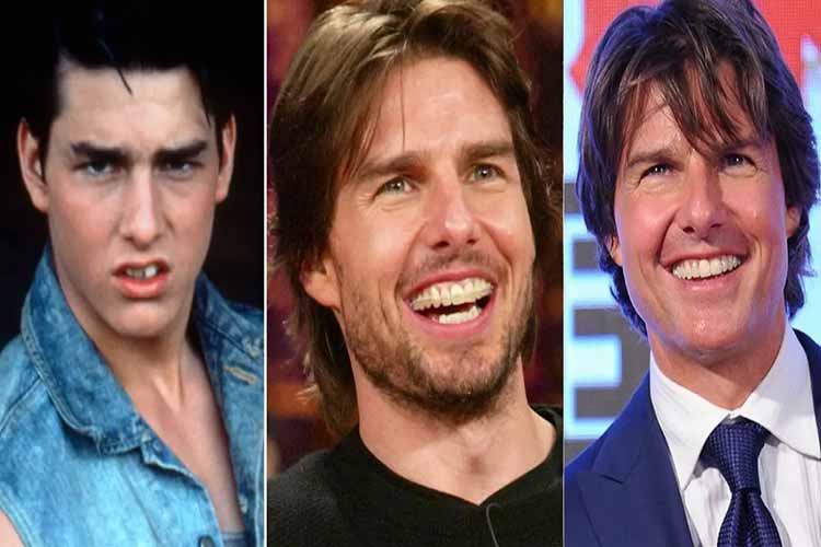 بازیگران هالیوودی که با تغییر لبخندشان مسیر حرفهای شان عوض شد 4 اشتباهات رایج در اجرای لبخند بازیگران هالیوودی