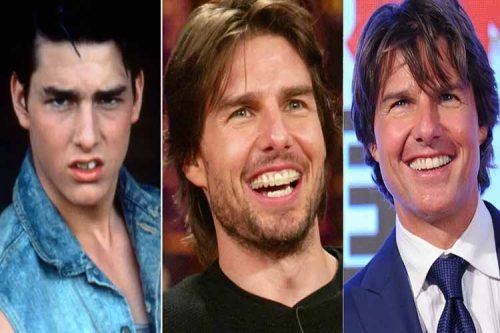 اشتباهات رایج در اجرای لبخند بازیگران هالیوودی